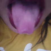 Mini_Gene